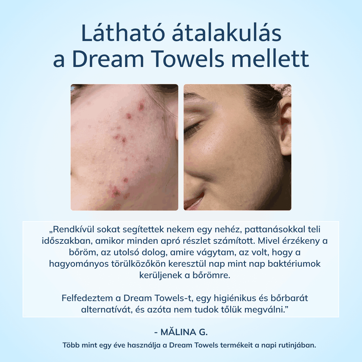Dream Towels Mini